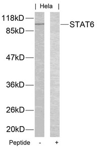 Western blot analysis of extracts from Hela cells using STAT6(Ab-645) Antibody and the same antibody preincubated with blocking peptide. Western blot analysis of extracts from Hela cells using STAT6(Ab-645) Antibody and the same antibody preincubated with blocking peptide.