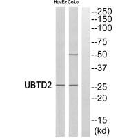 Western blot analysis of extracts from HuvEc cells and COLO cells, using UBTD2 antibody. Western blot analysis of extracts from HuvEc cells and COLO cells, using UBTD2 antibody.