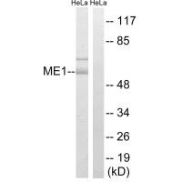 Western blot analysis of extracts from HeLa cells, using ME1 antibody. Western blot analysis of extracts from HeLa cells, using ME1 antibody.