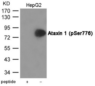 Western blot analysis of extracts from HepG2 cells using Ataxin 1 (Phospho-Ser776) Antibody.The lane on the left is treated with the antigen-specific peptide. Western blot analysis of extracts from HepG2 cells using Ataxin 1 (Phospho-Ser776) Antibody.The lane on the left is treated with the antigen-specific peptide.