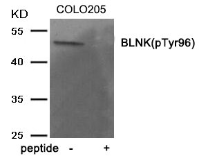 Western blot analysis of extracts from COLO205 tissue using BLNK (Phospho-Tyr96) antibody.The lane on the right is treated with the antigen-specific peptide. Western blot analysis of extracts from COLO205 tissue using BLNK (Phospho-Tyr96) antibody.The lane on the right is treated with the antigen-specific peptide.
