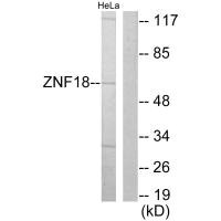 Western blot analysis of extracts from HeLa cells, using ZNF18 antibody. Western blot analysis of extracts from HeLa cells, using ZNF18 antibody.