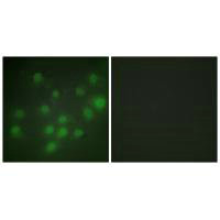 Immunofluorescence analysis of HUVEC cells, using HKR1 antibody.