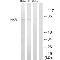 Western blot analysis of extracts from HeLa cells, Jurkat cells and COLO205 cells, using HKR1 antibody. Western blot analysis of extracts from HeLa cells, Jurkat cells and COLO205 cells, using HKR1 antibody.