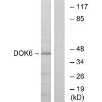 Western blot analysis of extracts from COLO cells, using DOK6 antibody. Western blot analysis of extracts from COLO cells, using DOK6 antibody.