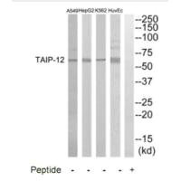 Western blot analysis of extracts from HuvEC, K562, HepG2 and A549 cells, using TAIP-12 antibody. Western blot analysis of extracts from HuvEC, K562, HepG2 and A549 cells, using TAIP-12 antibody.