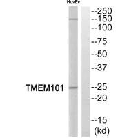 Western blot analysis of extracts from HuvEc cells, using TMEM101 antibody. Western blot analysis of extracts from HuvEc cells, using TMEM101 antibody.