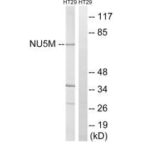 Western blot analysis of extracts from HT-29 cells, using MT-ND5 antibody. Western blot analysis of extracts from HT-29 cells, using MT-ND5 antibody.