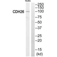 Western blot analysis of extracts from HuvEc cells, using Cytochrome P450 2C8 antiobdy. Western blot analysis of extracts from HuvEc cells, using Cytochrome P450 2C8 antiobdy.