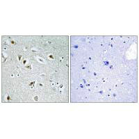 Immunohistochemistry analysis of paraffin-embedded human brain tissue, using CDKA2 antibody. Immunohistochemistry analysis of paraffin-embedded human brain tissue, using CDKA2 antibody.