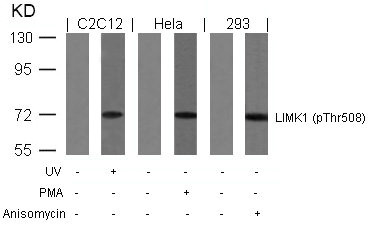 Western blot analysis of extracts from UV-treated C2C12, PMA-treated Hela and anisomycin-treated 293 cells using LIMK1(Phospho-Thr508) Antibody. Western blot analysis of extracts from UV-treated C2C12, PMA-treated Hela and anisomycin-treated 293 cells using LIMK1(Phospho-Thr508) Antibody.