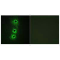 Immunofluorescence analysis of COS7 cells, using CDH8 antibody.