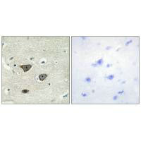 Immunohistochemistry analysis of paraffin-embedded human brain tissue using CDH8 antibody.