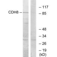 Western blot analysis of extracts from RAW264.7 cells, using CDH8 antibody. Western blot analysis of extracts from RAW264.7 cells, using CDH8 antibody.