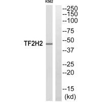 Western blot analysis of extracts from COLO205 cells, using TF2H2 antibody. Western blot analysis of extracts from COLO205 cells, using TF2H2 antibody.