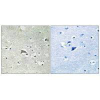Immunohistochemistry analysis of paraffin-embedded human brain tissue using VEGFR1 antibody. Immunohistochemistry analysis of paraffin-embedded human brain tissue using VEGFR1 antibody.