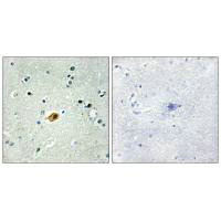 Immunohistochemistry analysis of paraffin-embedded human brain tissue using SOX8/9/17/18 antibody.