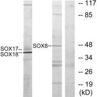 Western blot analysis of extracts from COS7 cells, untreated or treated with serum (10%, 30mins), using SOX8/9/17/18 antibody. Western blot analysis of extracts from COS7 cells, untreated or treated with serum (10%, 30mins), using SOX8/9/17/18 antibody.