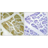 Immunohistochemistry analysis of paraffin-embedded human skeletal muscle tissue using MYH4 antibody. Immunohistochemistry analysis of paraffin-embedded human skeletal muscle tissue using MYH4 antibody.