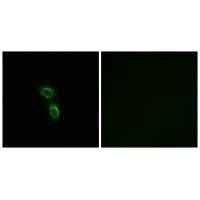 Immunofluorescence analysis of A549 cells, using ARMC6 antibody.