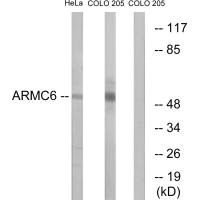 Western blot analysis of extracts from HeLa cells and COLO cells, using ARMC6 antibody. Western blot analysis of extracts from HeLa cells and COLO cells, using ARMC6 antibody.