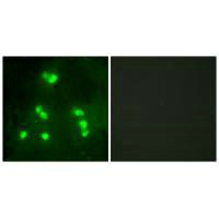 Immunofluorescence analysis of A549 cells, using HAIR antibody.