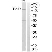 Western blot analysis of extracts from 293 cells, using HAIR antibody. Western blot analysis of extracts from 293 cells, using HAIR antibody.