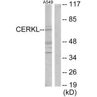 Western blot analysis of extracts from A549 cells, using CERKL antibody. Western blot analysis of extracts from A549 cells, using CERKL antibody.