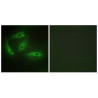 Immunofluorescence analysis of HeLa cells, using CDKL4 antibody.