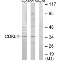 Western blot analysis of extracts from HepG2 cells and COLO205 cells, using CDKL4 antibody. Western blot analysis of extracts from HepG2 cells and COLO205 cells, using CDKL4 antibody.