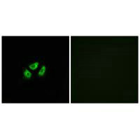 Immunofluorescence analysis of A549 cells, using SCN7A antibody. Immunofluorescence analysis of A549 cells, using SCN7A antibody.