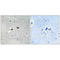 Immunohistochemistry analysis of paraffin-embedded human brain tissue, using TIGD3 antibody.