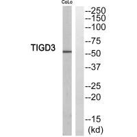 Western blot analysis of extracts from COLO205 cells, using TIGD3 antibody. Western blot analysis of extracts from COLO205 cells, using TIGD3 antibody.