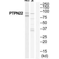 Western blot analysis of extracts from HeLa/Jurkat cells, using PTPN22 antibody. Western blot analysis of extracts from HeLa/Jurkat cells, using PTPN22 antibody.