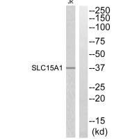 Western blot analysis of extracts from Jurkat cells, using SLC15A1 antibody. Western blot analysis of extracts from Jurkat cells, using SLC15A1 antibody.