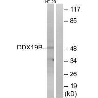 Western blot analysis of extracts from HT-29 cells, using DDX19B antibody. Western blot analysis of extracts from HT-29 cells, using DDX19B antibody.