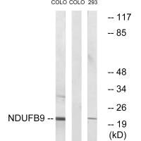 Western blot analysis of extracts from COLO cells and 293 cells, using NDUFB9 antibody.