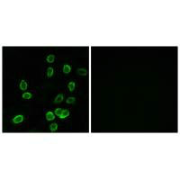 Immunofluorescence analysis of A549 cells, using ATP5G3 antibody.