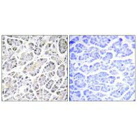 Immunohistochemistry analysis of paraffin-embedded human pancreas tissue using ATP5G3 antibody. Immunohistochemistry analysis of paraffin-embedded human pancreas tissue using ATP5G3 antibody.