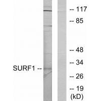 Western blot analysis of extracts from Jurkat cells, using SURF1 antibody. Western blot analysis of extracts from Jurkat cells, using SURF1 antibody.