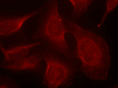Immunofluorescence staining of methanol-fixed Hela cells using BIM(Phospho-Ser69) Antibody.