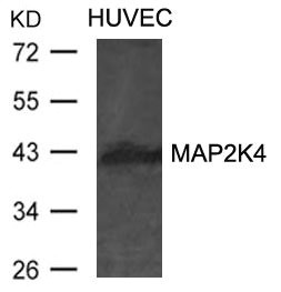 Western blot analysis of extracts from HUVEC cells using MAP2K4 Antibody. Western blot analysis of extracts from HUVEC cells using MAP2K4 Antibody.