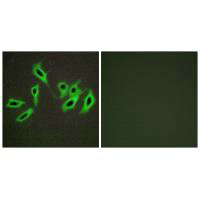 Immunofluorescence analysis of HepG2 cells, using Heparin Cofactor II antibody.