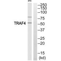 Western blot analysis of extracts from 3T3 cells, using TRAF4 antibody. Western blot analysis of extracts from 3T3 cells, using TRAF4 antibody.