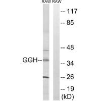 Western blot analysis of extracts from RAW264.7 cells, using GGH antibody. Western blot analysis of extracts from RAW264.7 cells, using GGH antibody.