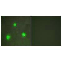 Immunofluorescence analysis of A549 cells, using FOXH1 antibody. Immunofluorescence analysis of A549 cells, using FOXH1 antibody.