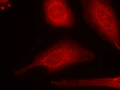 Immunofluorescence staining of methanol-fixed Hela cells using Smad3(Ab-425) Antibody.
