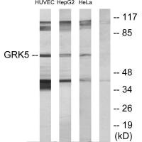 Western blot analysis of extracts from HUVEC cells, HepG2 cells and HeLa cells, using GRK5 antibody.