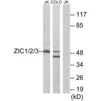 Western blot analysis of extracts from Jurkat cells and COLO cells, using ZIC1/2/3 antibody. Western blot analysis of extracts from Jurkat cells and COLO cells, using ZIC1/2/3 antibody.