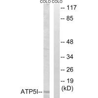 Western blot analysis of extracts from COLO cells, using ATP5I antibody. Western blot analysis of extracts from COLO cells, using ATP5I antibody.